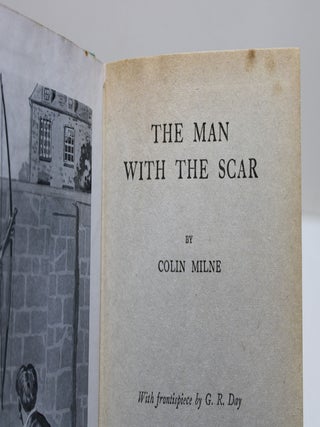 The Man with the Scar